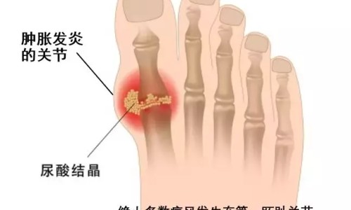 白酒泡玉米能逮野鸡吗-酒泡玉米喂鸡的功效与禁忌专区_酒泡玉米喂鸡的功效与禁忌专区_酒泡玉米喂鸡的功效网